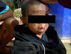 Sadis ! Anak 13 Tahun Dianiaya Berat di Ketapang, Polisi Tangani Kasusnya